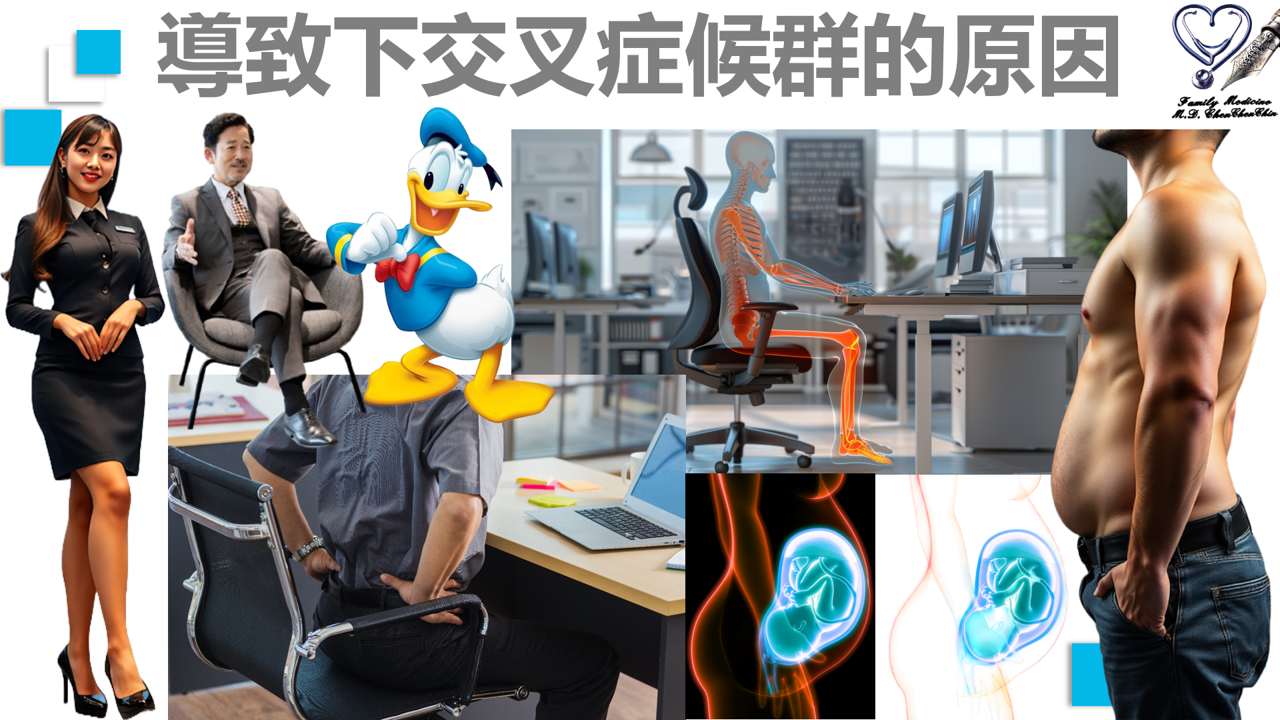 導致下交叉症候群的實際成因