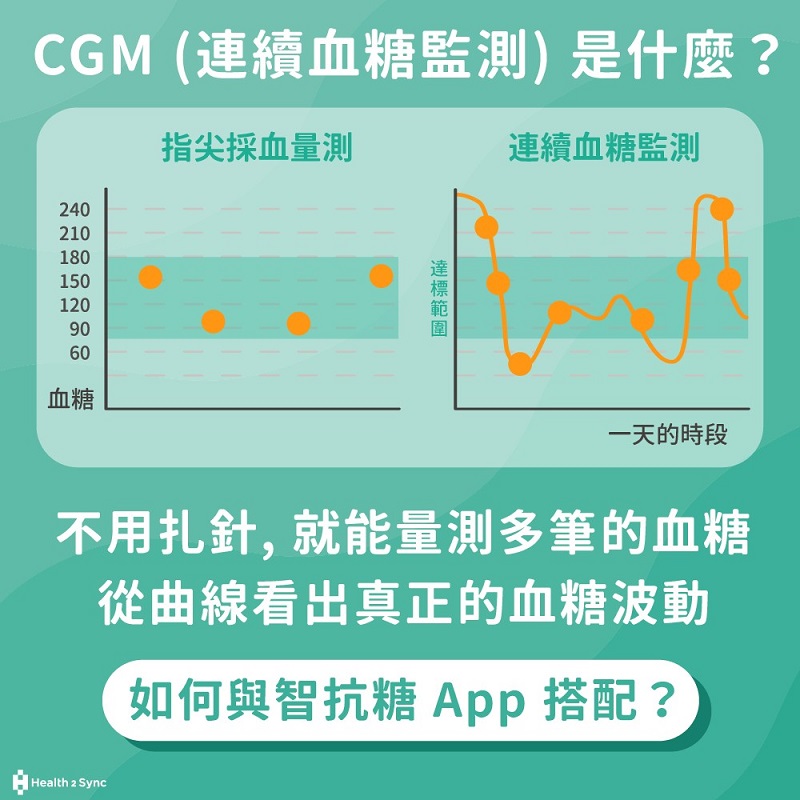 連續血糖監測cgm